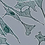 Fotografia macro ad alta definizione di cellule staminali mesenchimali umane (hucMSC) in una piastra di coltura. Alcune cellule appaiono sane, con la tipica morfologia allungata, altre mostrano alterazioni morfologiche indicative di stress da radiazioni (più grandi, più granulari). Obiettivo macro 100mm, illuminazione da laboratorio controllata, messa a fuoco selettiva su un gruppo di cellule, sfondo leggermente sfocato.