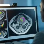 Immagine fotorealistica di un radiologo che analizza attentamente una scansione MRI multiparametrica della prostata su un monitor ad alta risoluzione, focus sull'interfaccia software che mostra mappe ADC colorate e un nodulo sospetto evidenziato nella zona di transizione con morfologia "nodulo nel nodulo", luce ambientale soffusa da studio medico, profondità di campo che sfoca lo sfondo, lente prime 35mm.