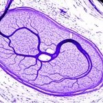 Immagine ad alta risoluzione ottenuta tramite Micro-CT che mostra una sezione trasversale di un'arteria renale di coniglio dopo embolizzazione con Glubran 2. Si visualizza il materiale embolico radiopaco all'interno del lume vascolare, con dettagli sulla sua integrità e sulla parete del vaso. Luce controllata, focus preciso, lente macro 80mm.