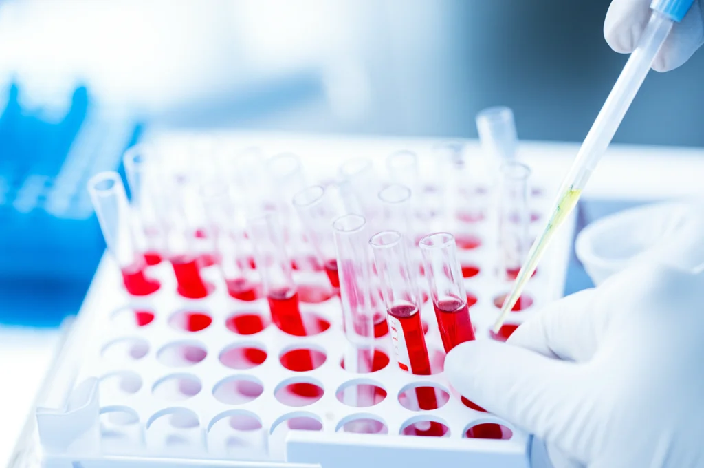 Primo piano macro di provette contenenti campioni di plasma in un rack di laboratorio, una mano guantata con una pipetta sta prelevando o depositando liquido in una di esse, luce da laboratorio brillante e controllata, obiettivo macro 100mm, alta definizione, focus sulla punta della pipetta e sulla provetta.