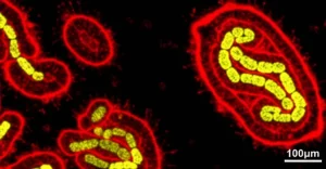 Microscopia a super-risoluzione di cellule di Escherichia coli in rapida crescita, che mostra il nucleoide (DNA, colorato in giallo fluorescente e strutturato) condensato e localizzato vicino alla membrana interna (rossa). Macro lens, 100mm, high detail, precise focusing, controlled lighting, vista dettagliata della struttura cellulare.
