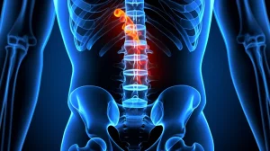 Visualizzazione 3D astratta dell'allineamento spino-pelvico sagittale umano, con enfasi sulla regione toracolombare che mostra una curvatura cifotica, concetto medico scientifico, alta risoluzione, illuminazione drammatica focalizzata sulla colonna, sfondo scuro.