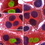 Immagine macro ad alta definizione di cellule di cancro al colon colorate per immunoistochimica, che mostrano l'espressione proteica di IL-10 in rosso e STAT3 in verde nel nucleo. Illuminazione controllata, obiettivo macro 100mm, alta definizione, profondità di campo.