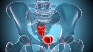 Visualizzazione 3D del bacino maschile con la prostata evidenziata in rosso, derivata da scansione RM, stile wide-angle 24mm, focus nitido sulla prostata e sulle strutture ossee pelviche circostanti (ischio, pube), illuminazione chiara e dettagliata per uso medico.