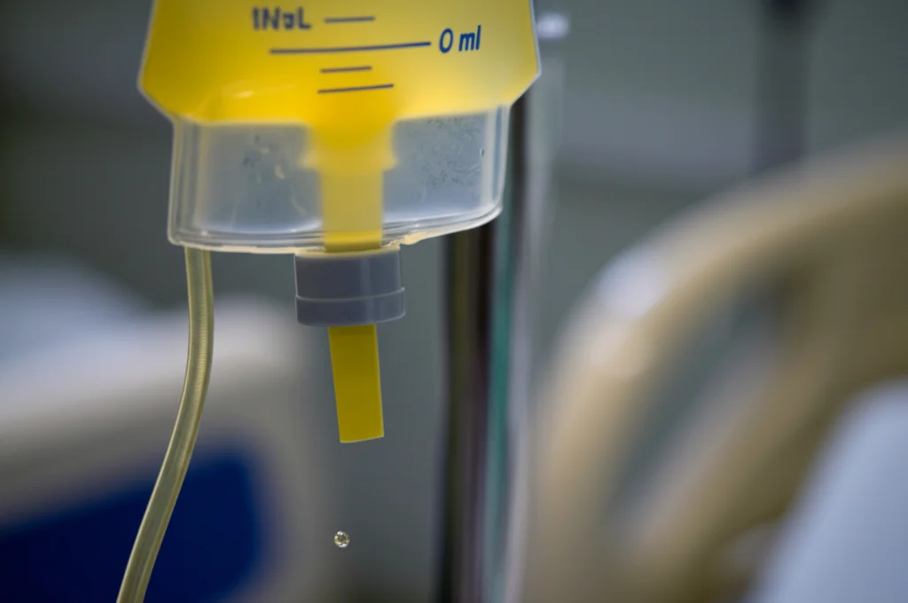 Macro fotografia, obiettivo 100mm, di gocce di urina molto chiara che cadono in una sacca di raccolta graduata trasparente, appesa accanto a un letto d'ospedale. Illuminazione controllata per evidenziare la trasparenza del liquido, alta definizione dei dettagli della sacca e delle gocce.