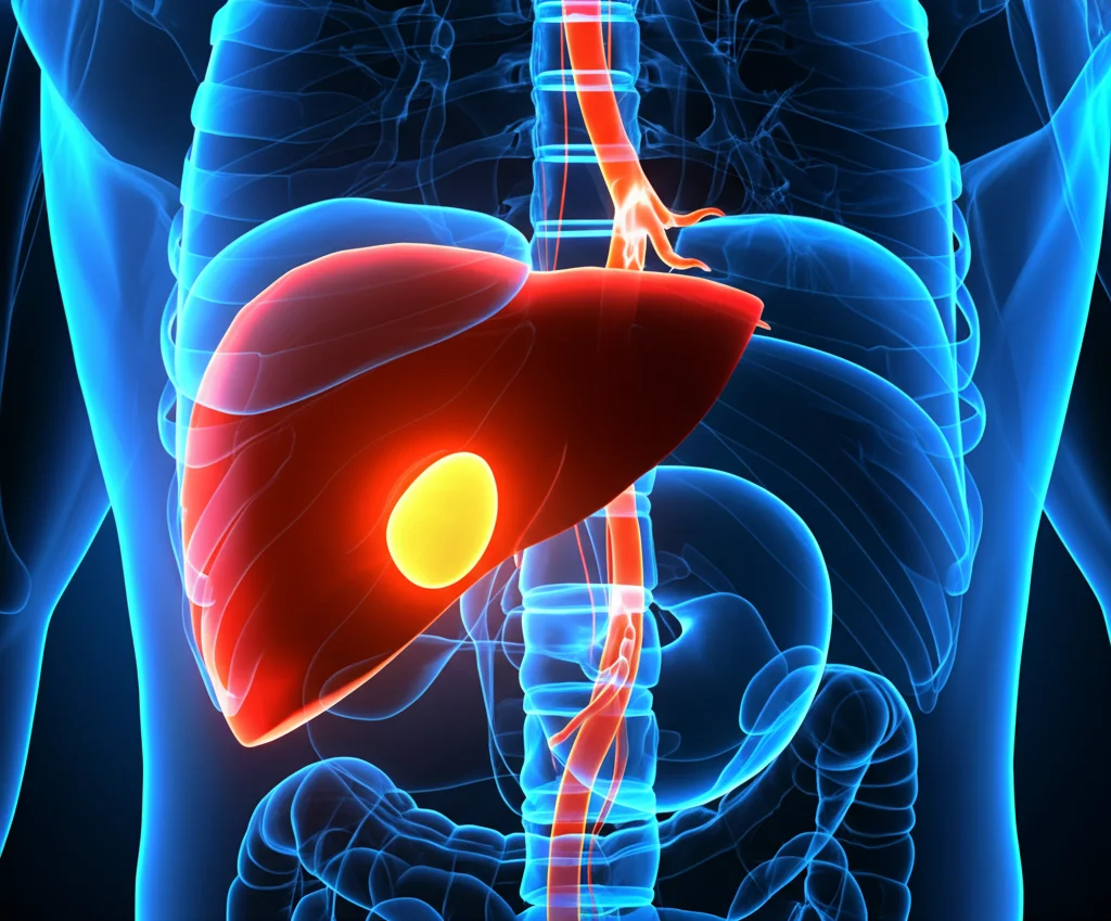 Visualizzazione medica 3D generata da TAC Dual-Energy che mostra il fegato e la milza ingranditi di un paziente con cirrosi, evidenziando con colori contrastanti le varici esofagee lungo l'esofago e le aree di perfusione alterata nel fegato, illuminazione drammatica per enfatizzare i dettagli patologici, obiettivo virtuale 50mm, alta risoluzione.