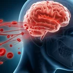 Immagine concettuale fotorealistica che mostra globuli rossi stilizzati che fluiscono verso un cervello umano parzialmente trasparente, simboleggiando il legame tra anemia (carenza di globuli rossi) e salute cerebrale post-ictus, illuminazione drammatica con contrasti netti, stile high detail.