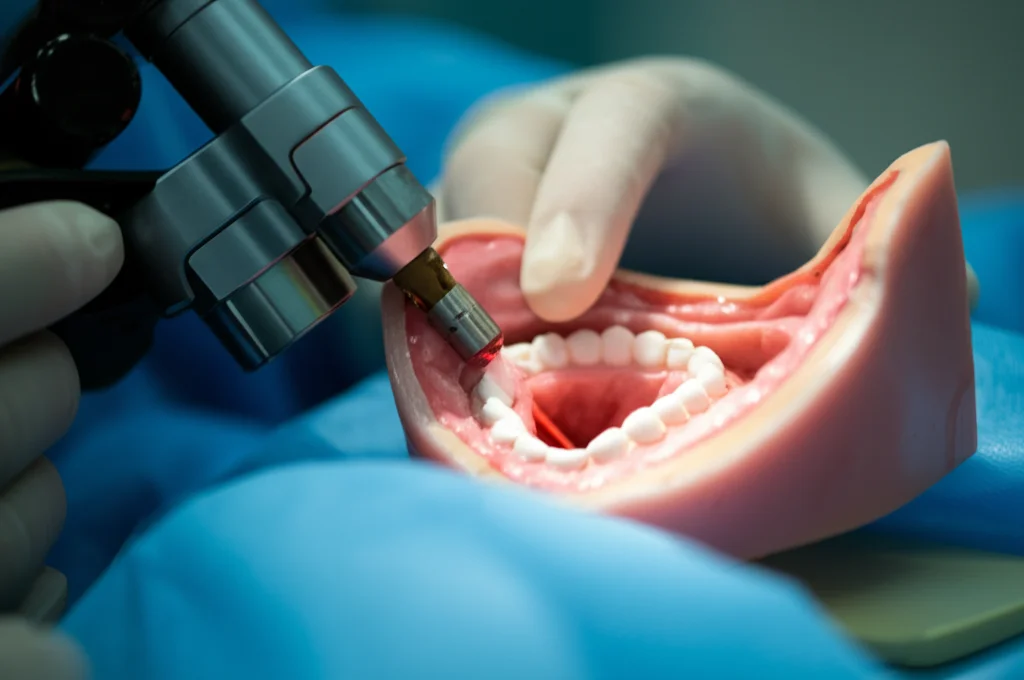 Primo piano di un chirurgo ORL che esegue una microchirurgia laser transorale (TLM) su un modello di laringe, obiettivo prime 35mm, profondità di campo, luce chirurgica focalizzata, dettagli anatomici precisi.
