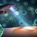 Immagine concettuale fotorealistica: una mano che proietta fasci di luce blu e verde su cellule staminali mesenchimali fluttuanti sopra una ferita in via di guarigione. Effetto bokeh sullo sfondo, illuminazione suggestiva, focus sulle cellule e la luce. Obiettivo prime 35mm, profondità di campo.