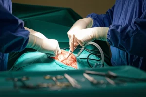 Primo piano delle mani guantate di un chirurgo che esegue con precisione un intervento di citoriduzione per cancro ovarico in una sala operatoria moderna. Luce chirurgica intensa che illumina il campo operatorio, dettagli nitidi degli strumenti chirurgici e dei tessuti. Scatto con obiettivo prime 35mm, profondità di campo ridotta per focalizzare l'attenzione sulle mani e l'azione chirurgica.