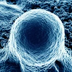 Lenti macro, 90 mm, dettagli elevati, illuminazione controllata, rappresentazione visiva delle molecole di interleuchina-6 (IL-6) che interagiscono con un recettore delle cellule tumorali, innescando una cascata di segnalazione intracellulare che coinvolge la fosforilazione di Akt1 e CDO1, enfatizzando la complessità molecolare e la microvironment infiammatoria.