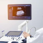 Immagine fotorealistica di un medico che esamina uno schermo ecografico avanzato che mostra dati di ecografia magnetomotiva dei linfonodi, lente prime 35mm, profondità di campo, trasmettendo l'avanzamento tecnologico nella diagnostica del cancro.