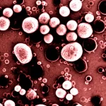 Micrografia elettronica a trasmissione ad altissima risoluzione che mostra il fungo Phialophora americana all'interno di un macrofago umano, evidenziando le strutture fungine scure e le vescicole cellulari circostanti, illuminazione scientifica precisa, dettagli ultrastrutturali.