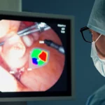 Primo piano fotorealistico di un chirurgo che osserva attentamente uno schermo durante una chirurgia endoscopica ipofisaria. Lo schermo mostra una vista endoscopica chiara con sovrapposizioni AI fornite da ConsisTNet, stabili e precise, che evidenziano strutture anatomiche critiche come la sella turcica. Espressione concentrata ma fiduciosa del chirurgo. Illuminazione da sala operatoria, riflessi realistici sullo schermo. Obiettivo prime 50mm, profondità di campo che isola lo schermo e il volto del chirurgo.