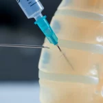 Primo piano fotorealistico di un modello anatomico avanzato per simulazione medica: una sezione trasversale mostra una colonna vertebrale scoliotica stampata in 3D (acciaio) immersa in gelatina trasparente che simula i tessuti molli. Accanto, una siringa con ago pronta per la simulazione di puntura. Lente macro 85mm, illuminazione da studio controllata, alta definizione dei dettagli, messa a fuoco selettiva sull'interfaccia ago-gelatina.