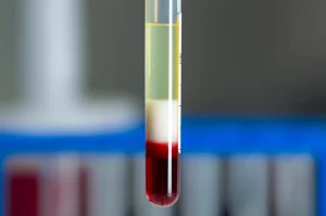 Immagine macrofotografica ad alto dettaglio di una provetta contenente strati separati di sangue dopo centrifugazione, con focus sullo strato bianco del buffy coat tra il plasma giallastro e i globuli rossi depositati sul fondo. Illuminazione controllata da laboratorio, lente macro 100mm, alta precisione di messa a fuoco.