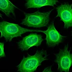 Immagine macro ad alta definizione di cellule staminali mesenchimali ossee (BMSC) che resistono attivamente allo stress ossidativo in una piastra di coltura, con dettagli precisi delle membrane cellulari e illuminazione controllata, focale 100mm. Alcune cellule mostrano fluorescenza verde (simulando EGFP) indicando modifiche genetiche protettive contro la ferroptosi, sullo sfondo si intravede una rappresentazione stilizzata di un disco intervertebrale.