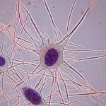 Visualizzazione artistica al microscopio di telociti epatici che mostrano la loro struttura unica con lunghi telopodi, con un focus sulla differenziazione cellulare compromessa a causa della mutazione Npc1. Macro lens, 85mm, high detail, controlled lighting, sfondo leggermente sfocato per enfatizzare le cellule.