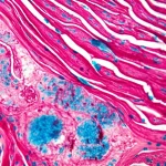Immagine fotorealistica al microscopio di un cuore di pesce zebra durante la rigenerazione cardiaca. Evidenzia l'interfaccia tra il tessuto cardiaco sano (cardiomiociti organizzati) e l'area danneggiata in via di riparazione, con cellule immunitarie (macrofagi) e cardiomiociti che protrudono nella zona della cicatrice. Macro lens 60mm, alta risoluzione, profondità di campo che sfoca leggermente lo sfondo.