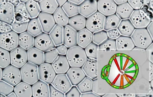 Primo piano estremo dell'endotelio corneale visto al microscopio, mostrando cellule esagonali. Alcune cellule presentano piccole inclusioni scure (guttae stilizzate), segno distintivo della distrofia di Fuchs. Sovrapposta all'immagine, una rappresentazione astratta di un filamento di RNA con segmenti evidenziati che indicano alterazioni di splicing. Obiettivo macro 100mm, profondità di campo ridotta, illuminazione da laboratorio chiara e dettagliata.