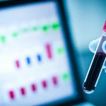 Immagine fotorealistica: Primo piano di una provetta di sangue con una debole lettura della carica virale visibile su un monitor vicino, obiettivo macro 90mm, alto dettaglio, messa a fuoco precisa, illuminazione controllata da laboratorio con sottili duotoni blu e bianco, simboleggiante il rilevamento della viremia HIV a basso livello.