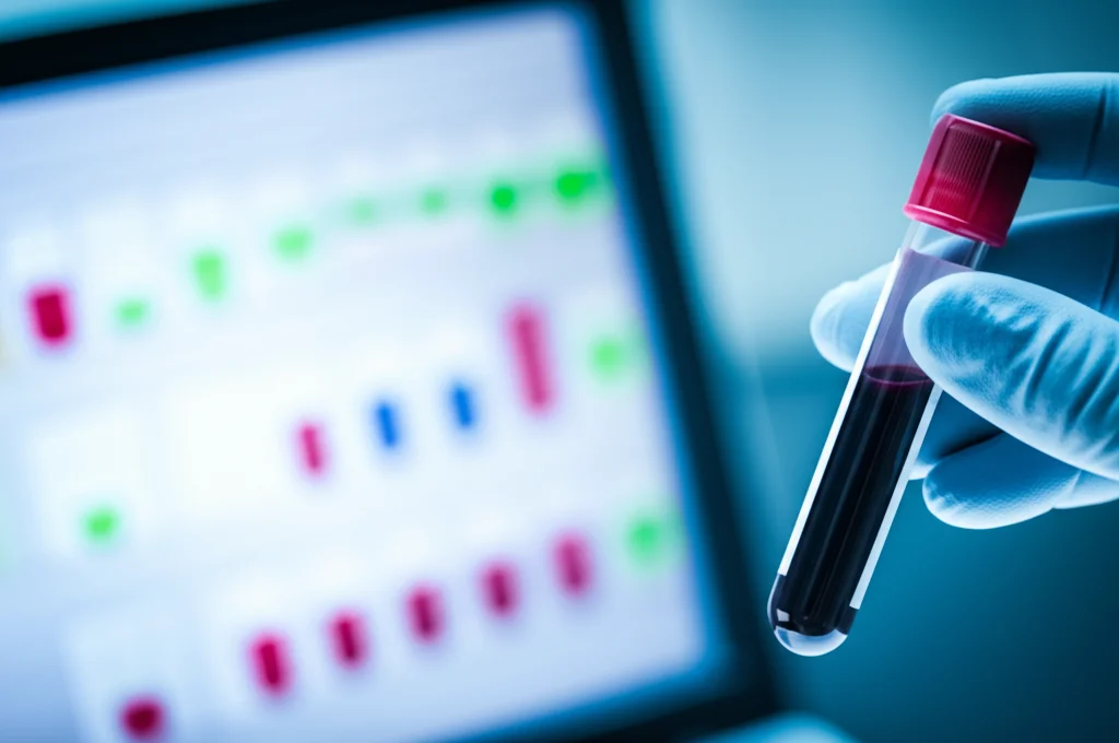 Immagine fotorealistica: Primo piano di una provetta di sangue con una debole lettura della carica virale visibile su un monitor vicino, obiettivo macro 90mm, alto dettaglio, messa a fuoco precisa, illuminazione controllata da laboratorio con sottili duotoni blu e bianco, simboleggiante il rilevamento della viremia HIV a basso livello.