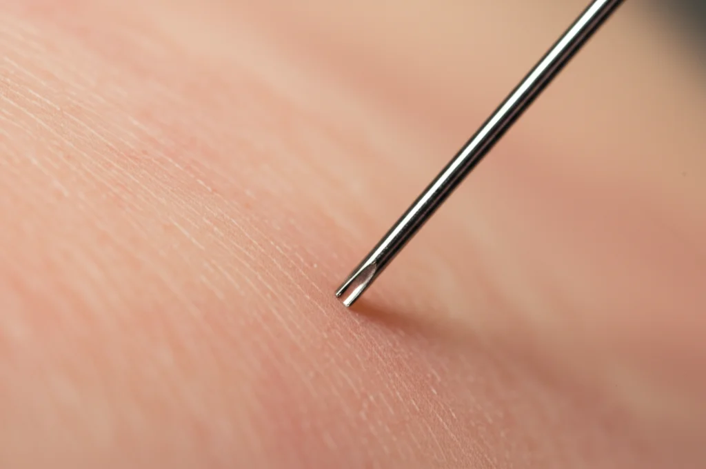 Immagine macro fotorealistica di un ago sottile durante un agoaspirato tiroideo, focus preciso sulla punta dell'ago e sulla texture della pelle del collo, illuminazione clinica controllata, alta definizione dei dettagli, 100mm Macro lens.