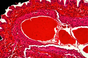 Immagine macro fotorealistica di una sezione trasversale di radice aortica di topo colorata con Oil Red O, che mostra placche aterosclerotiche rosse brillanti all'interno della parete arteriosa. Illuminazione controllata, obiettivo macro 100mm, alta definizione, messa a fuoco precisa sui dettagli della placca.