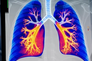 Visualizzazione 3D fotorealistica di polmoni umani con mappe di ventilazione colorate sovrapposte (dal blu/freddo per bassa ventilazione al rosso/caldo per alta ventilazione), generate tramite CTVI senza contrasto, mostrata su uno schermo diagnostico in un ambiente medico high-tech. Macro lens, 85mm, alta definizione, illuminazione da studio medico focalizzata sull'immagine polmonare.