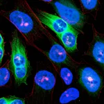 Ricerca sul cancro al fegato in laboratorio, visualizzazione microscopica di cellule tumorali HCC con evidenziazione fluorescente delle proteine USP24 e YAP1, obiettivo macro 100mm, illuminazione controllata ad alto dettaglio, stile fotorealistico.
