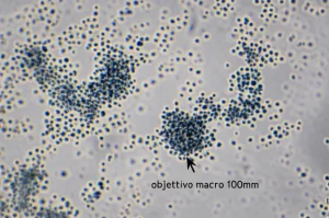 Visualizzazione macro di complessi proteici anticorpo-antigene (Fab-HEL) che mostrano aggregazione reversibile in una soluzione tampone, obiettivo macro 100mm, illuminazione controllata per evidenziare la torbidità variabile, messa a fuoco precisa sulle particelle aggregate in sospensione, sfondo sfocato da laboratorio.