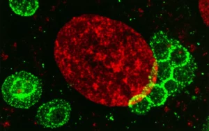 Illustrazione scientifica fotorealistica di un macrofago umano al microscopio elettronico, con enfasi sul nucleo dove la proteina NF-κB (visualizzata con fluorescenza rossa) interagisce con la cromatina marcata da H3K27me3 (fluorescenza verde), sopprimendo l'autofagia. Lente macro 100mm, alta definizione, illuminazione drammatica.