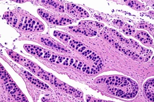Immagine microscopica fotorealistica ad alto dettaglio che mostra cellule B regolatrici (Breg) interagenti con cellule T nel contesto del tessuto pancreatico. Si vedono chiaramente i diversi tipi cellulari e le strutture tissutali. Obiettivo macro, 100mm, messa a fuoco precisa, illuminazione controllata per evidenziare le cellule.