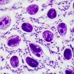 Immagine macro ad alta definizione di cellule tumorali della vescica su un vetrino da laboratorio, 100mm macro lens, illuminazione controllata e precisa, che mostra sottili differenze morfologiche potenzialmente legate all'espressione dell'enzima IDO1, focus nitido sulle cellule, sfondo leggermente sfocato per profondità di campo.