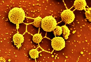 Immagine macrofotografica ad alta definizione, scattata con obiettivo macro da 100mm, che mostra nanoparticelle sferiche scintillanti (argento/selenio) su cui aderiscono molecole gialle (bisdemetossicurcumina), con sfondo sfocato di cellule tumorali mammarie. Illuminazione controllata per evidenziare i dettagli.