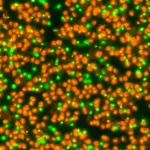 Close-up fotorealistico di cellule di lievito luminose sotto un microscopio, che simboleggiano la scoperta del meccanismo di auto-sumoilazione di Ubc9 che estende la durata della vita cellulare, obiettivo macro 90mm, alta definizione, illuminazione controllata.