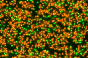 Close-up fotorealistico di cellule di lievito luminose sotto un microscopio, che simboleggiano la scoperta del meccanismo di auto-sumoilazione di Ubc9 che estende la durata della vita cellulare, obiettivo macro 90mm, alta definizione, illuminazione controllata.