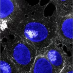 Microscopia ad alta risoluzione, obiettivo macro 100mm, messa a fuoco precisa su vescicole extracellulari (sEVs) derivate da microglia M2 che interagiscono con cellule staminali neurali (NSC) in un contesto di danno ischemico cerebrale simulato, illuminazione controllata laterale per creare profondità, dettagli elevati delle membrane cellulari e delle vescicole internalizzate dalle NSC.
