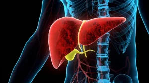 Concettualizzazione del legame tra chirurgia del cancro al pancreas e rischio di tromboembolismo venoso, con focus sui fattori di coagulazione sanguigna. Obiettivo macro, 85mm, dettaglio elevato, illuminazione controllata, rappresentazione simbolica.