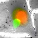 Microscopia a fluorescenza ad alta risoluzione che mostra la fusione tra una cellula di glioma (verde brillante, GFP) e una cellula staminale mesenchimale associata al glioma (rosso brillante, mCherry) all'interno di un tessuto cerebrale stilizzato, evidenziando la formazione di una cellula ibrida giallo/arancione. Illuminazione controllata, obiettivo macro 100mm, alta definizione, focus preciso sulla cellula ibrida.