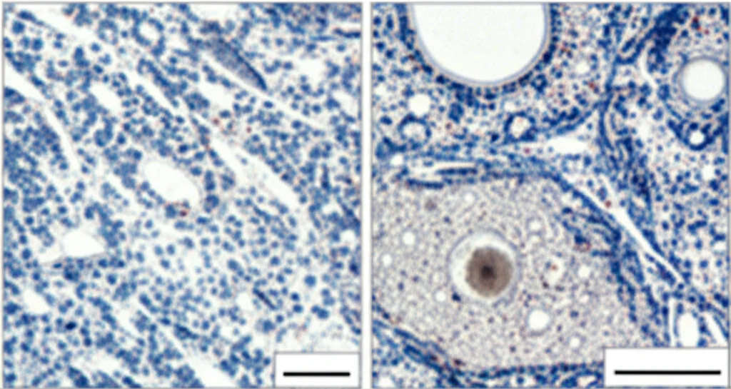 Immagine macro di cellule epiteliali intestinali in coltura, alcune trattate con Vitamina D mostrano meno accumulo di lipidi rispetto alle controllo. Illuminazione controllata da laboratorio, alta definizione, obiettivo macro 90mm.
