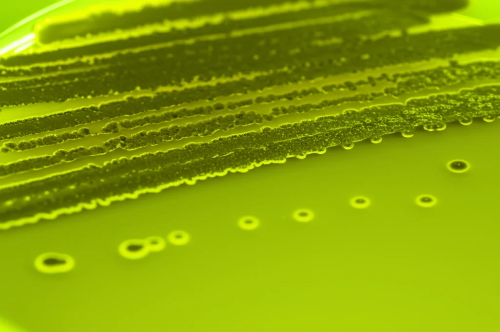 Primo piano macro di una colonia batterica di Pseudomonas aeruginosa su una piastra di Petri con terreno Cetrimide Agar, che mostra la tipica fluorescenza giallo-verde. Obiettivo macro 100mm, illuminazione da laboratorio controllata, alta definizione dei dettagli coloniali.