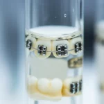 Macro fotografia di diversi tipi di bracket ortodontici (metallo lucido, ceramica bianca traslucida, autolegante complesso) parzialmente immersi in un liquido trasparente leggermente torbido in una provetta di vetro da laboratorio, illuminazione controllata che crea riflessi sulla superficie liquida e sui bracket, messa a fuoco precisa sui dettagli della superficie dei bracket, alcuni mostrano lievi segni di corrosione superficiale, obiettivo macro 100mm, alta definizione, sfondo sfocato da laboratorio.