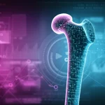 Immagine concettuale che mostra una testa del femore umana stilizzata, metà osso sano e metà con pattern digitali sovrapposti rappresentanti l'analisi radiomica, su uno sfondo tecnologico astratto con linee di codice e grafici sfocati, illuminazione drammatica high-tech, obiettivo macro 90mm per dettaglio sulla texture ossea e digitale, colori duotone ciano e magenta.