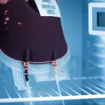 Fotografia realistica di una sacca di sangue (pRBC) in un frigorifero medico specializzato, con un termometro digitale che segna una temperatura vicina allo zero (-5°C). Luce fredda interna al frigo, profondità di campo che mette a fuoco la sacca e il termometro, obiettivo 35mm, per trasmettere l'idea di conservazione controllata ma esposta a temperature sottozero.