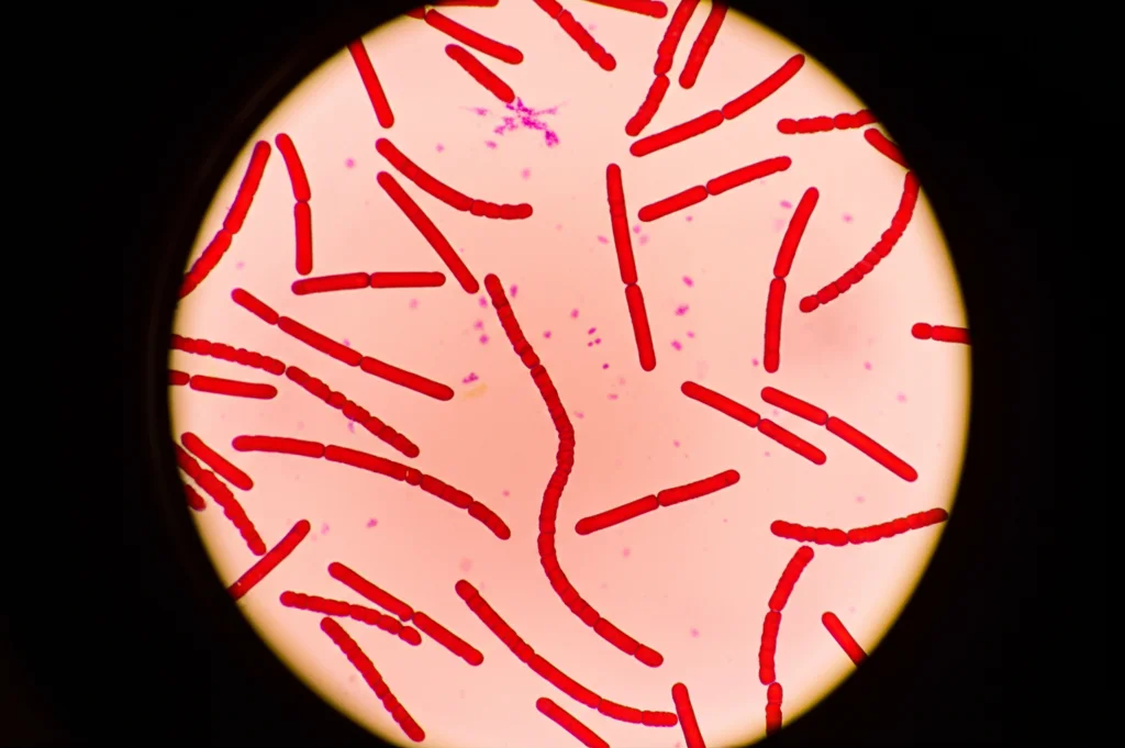 Immagine macro di un vetrino da microscopio con batteri Mycobacterium tuberculosis visibili sotto una luce intensa, messa a fuoco selettiva sui bacilli rossi, obiettivo macro 100mm, illuminazione controllata ad alto contrasto.