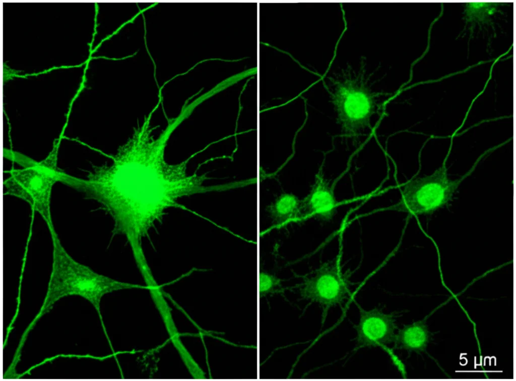Immagine fotorealistica divisa in due pannelli verticali, lente prime 35mm. Pannello sinistro: Neuroni corticali sani in coltura con dendriti e assoni intatti e complessi. Pannello destro: Neuroni simili dopo esposizione a miRNA extracellulari, mostrano dendriti accorciati, assoni frammentati e alcuni nuclei con marcatori di apoptosi (punti verdi brillanti, effetto TUNEL). Profondità di campo ridotta per focalizzare sui cambiamenti strutturali. Illuminazione controllata.