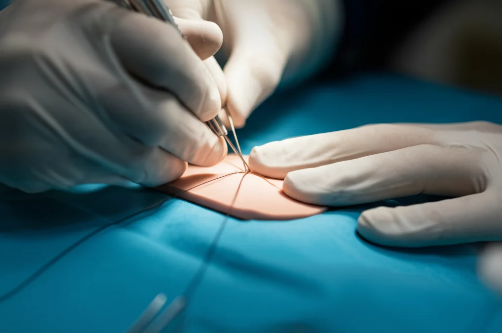 Primo piano di mani guantate di uno studente di medicina che esegue una sutura su un pad di simulazione chirurgica, illuminazione da studio controllata, obiettivo macro 100mm, alta definizione dei dettagli del filo e della 'pelle' sintetica.