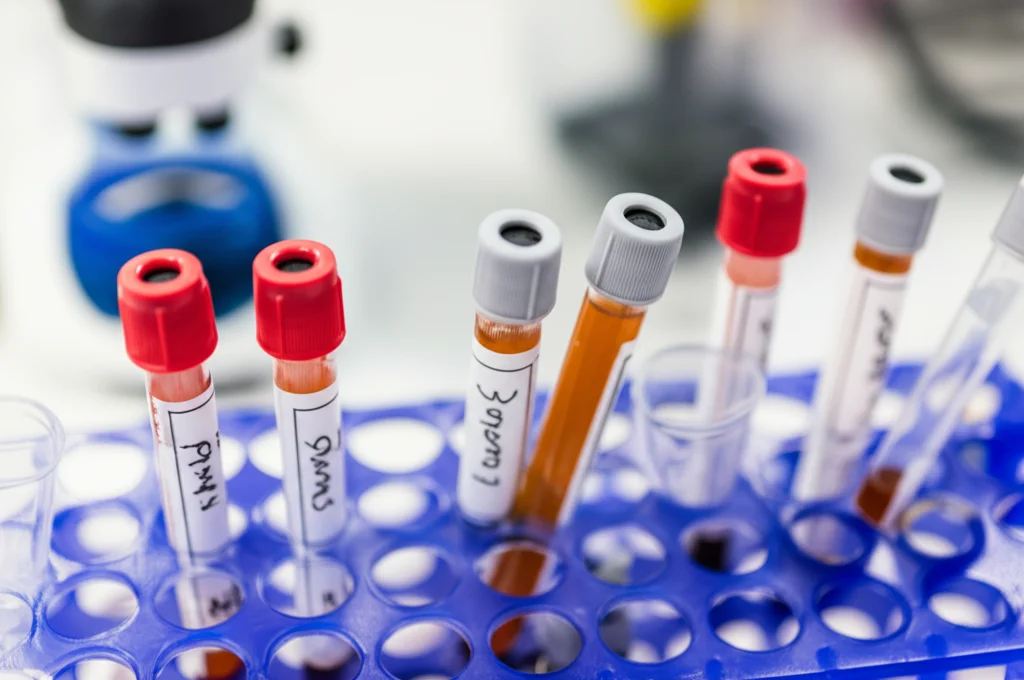 Primo piano di provette contenenti campioni di siero sanguigno in un rack da laboratorio, illuminazione controllata da laboratorio, obiettivo macro 100mm, alta definizione dei dettagli, messa a fuoco precisa sulle etichette.