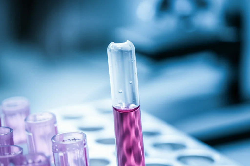 Primo piano macro di una provetta di siero sanguigno in un rack da laboratorio, con riflessi di luce controllata sulla superficie liquida. Obiettivo macro 100mm, alta definizione, messa a fuoco precisa sul siero, sfondo sfocato con attrezzature scientifiche.